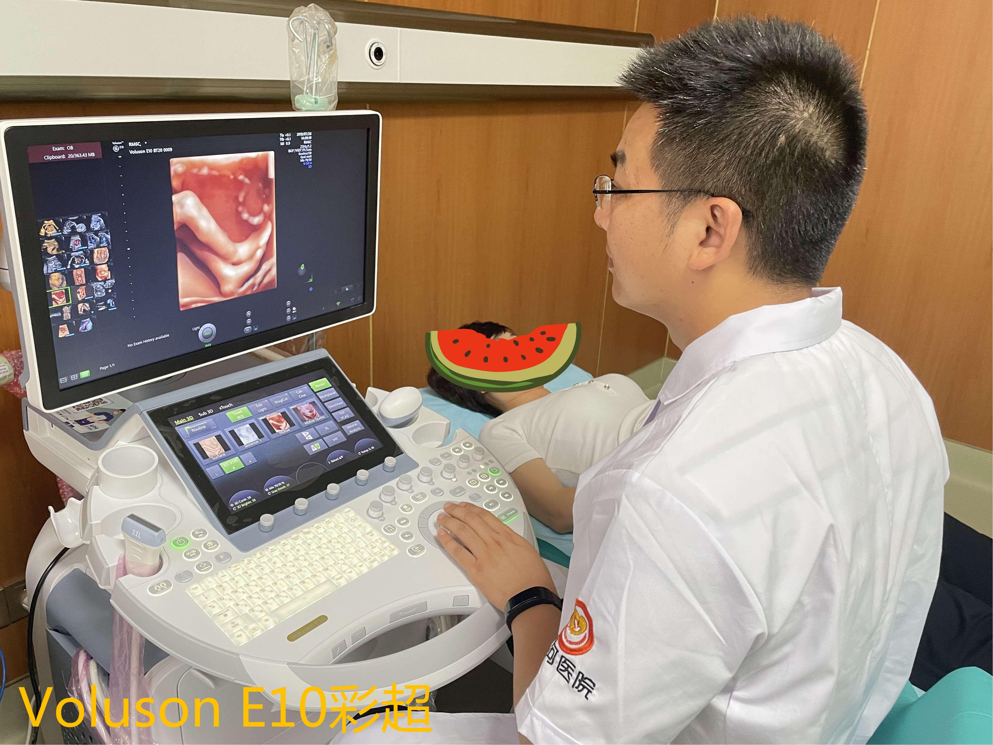 Voluson E10 彩超